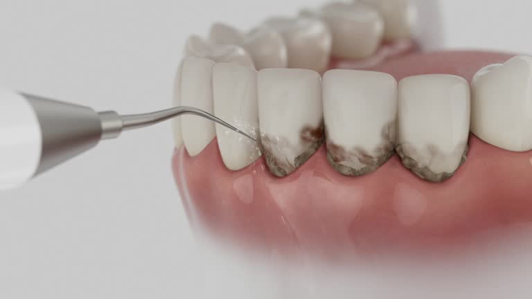 Reliable Dental contractor in Westphalia, MD by Smile Center Dentistry